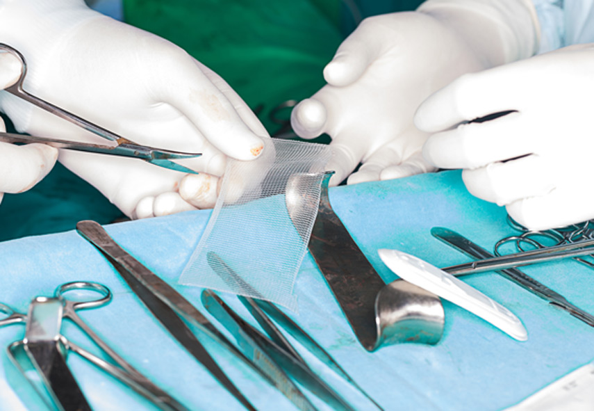 Surgeon-preparing-mesh-for-hernia-repair